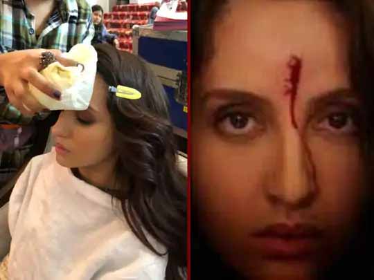 नोरा का डेडिकेशन:’भुजः द प्राइड ऑफ इंडिया’ का एक्शन सीन शूट करते हुए बुरी तरह जख्मी हुई थीं नोरा फतेही, असली चोट के साथ की शूटिंग