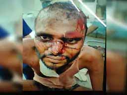 बाइक के लिए दोस्त ही बना जल्लाद:गोलगप्पे के मसाले में चूहे मारने की दवा मिलाई, फिर गले और सिर पर चाकू से किए 10 वार, गला घोंटा, फिर मरा समझ मौके पर ही छोड़ा