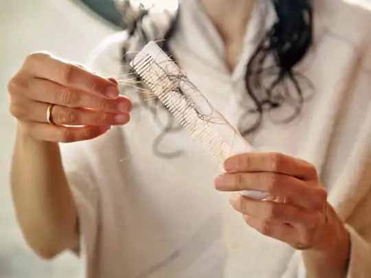 पोस्ट कोविड का असर:रिकवरी के 30 दिन बाद मरीजों में बाल टूटने के मामले बढ़ रहे, इसकी वजह हार्मोन में बदलाव, वजन घटना और पोषक तत्वों की कमी