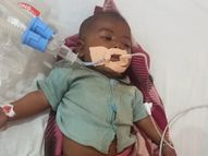 5 महीने की बच्ची की बीमारी जड़ से खत्म करना चाहते थे माता-पिता, दो बार गर्म सरिए से दाग दिया; अब वेंटिलेटर पर लड़ रही मौत से जंग