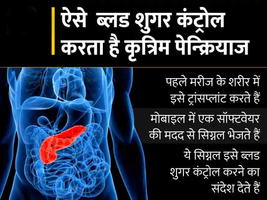 राहत देने वाली रिसर्च:वैज्ञानिकों ने विकसित किया ‘कृत्रिम पेन्क्रियाज’, यह ब्लड शुगर को कंट्रोल करेगा और बार-बार इंसुलिन इंजेक्शन लेने से मिलेगी मुक्ति