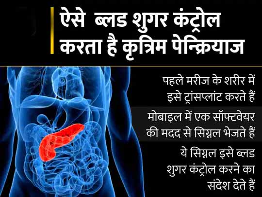 राहत देने वाली रिसर्च:वैज्ञानिकों ने विकसित किया ‘कृत्रिम पेन्क्रियाज’, यह ब्लड शुगर को कंट्रोल करेगा और बार-बार इंसुलिन इंजेक्शन लेने से मिलेगी मुक्ति