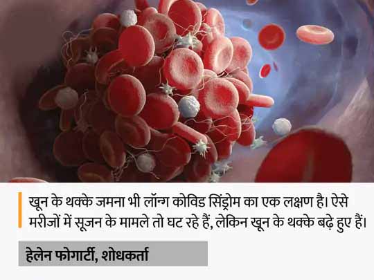 आयरलैंड के वैज्ञानिकों का दावा:खून के थक्के जमना हो सकती है लॉन्ग कोविड की वजह, शरीर में थकान महसूस होने पर इसकी जांच कराएं