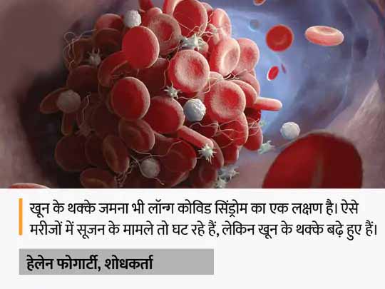 आयरलैंड के वैज्ञानिकों का दावा:खून के थक्के जमना हो सकती है लॉन्ग कोविड की वजह, शरीर में थकान महसूस होने पर इसकी जांच कराएं