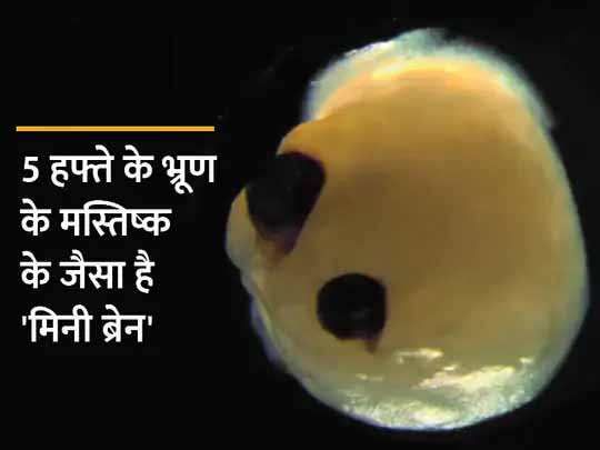 आंखों से दिमाग का तालमेल समझाएगा मिनी ब्रेन:जर्मनी के वैज्ञानिकों ने स्टेम सेल्स से लैब में विकसित किया कृत्रिम ह्यूमन ब्रेन, इसमें आंखें भी विकसित हुईं; जानिए क्यों है यह खास