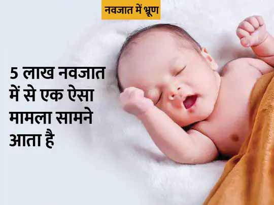 इजराइल में चौंकाने वाला मामला:नवजात बच्ची के पेट में मिले एक से ज्यादा भ्रूण, 10 हफ्ते पुराने सभी भ्रूण में हड्डियां और हार्ट विकसित हो चुके थे; सर्जरी करके हटाया