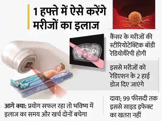 कैंसर के खिलाफ लंदन में 900 मरीजों पर ट्रायल शुरू:प्रोस्टेट कैंसर का एक हफ्ते में होगा इलाज, रेडिएशन की 2 हाई डोज से ट्यूमर खत्म करेंगे एक्सपर्ट; जानिए डॉक्टर्स कैसे करेंगे मरीजों का इलाज