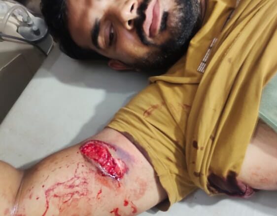 पुलिस की छापेमारी पर मुखबिरी के संदेह में शराब ठेके के सेल्समैन को गोलियां मारकर घायल किया