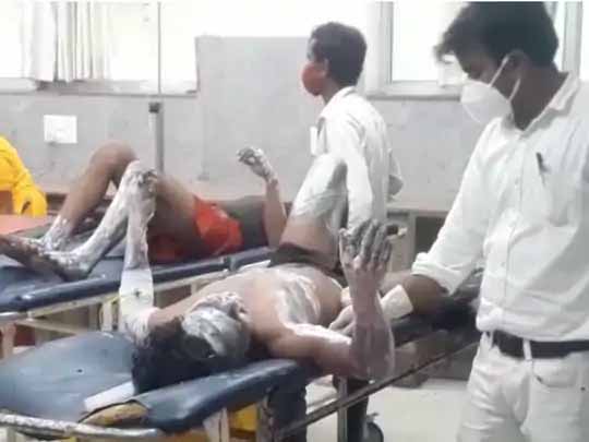 ससुराल में दामाद ने खुद को लगाई आग:उधारी के पैसे नहीं देने पर साले से नाराज था, बचाने में खुद की पत्नी, सास और साला भी झुलसा; घर में चल रहा था कार्यक्रम