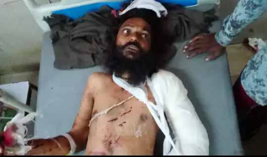 शराब पीने से टोका तो महाराज का अंगूठा काटा:कोटा के भैरू मंदिर में सो रहे MP के रहने वाले महाराज पर बदमाशों ने आधी रात गंडासे व लाठी से किए वार, एक हाथ तोड़ा
