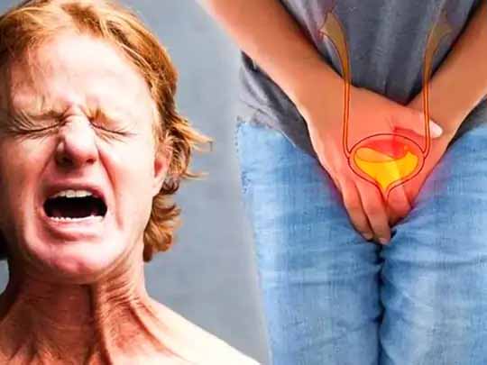 प्रोस्टेट कैंसर अवेयरनेस मंथ:पेशाब करते समय तेज दर्द या इसमें खून आना भी है प्रोस्टेट कैंसर का लक्षण, पुरुषों में होने वाले इस कैंसर के सबसे ज्यादा मामले बड़े शहरों में