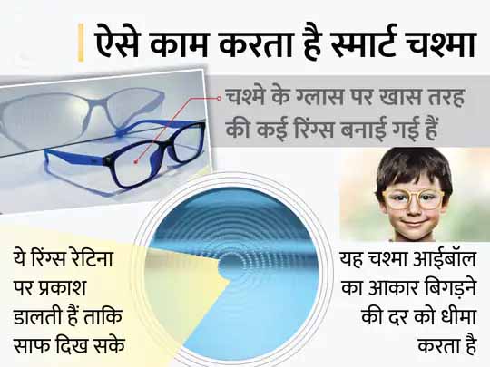 मायोपिया रोकने वाला स्मार्ट चश्मा:चीनी वैज्ञानिकों ने मायोपिया के बढ़ते असर को धीमा करने वाला स्मार्ट चश्मा बनाया, दूर की चीजें देखना हुआ आसान; दो साल में 67% घटा बीमारी का असर