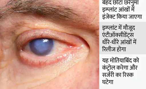 घटती आंखों की रोशनी को कंट्रोल करने की कोशिश