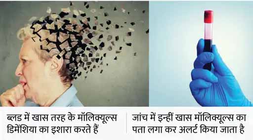 ब्लड टेस्ट से दो साल पहले की जा सकेगी डिमेंशिया की भविष्यवाणी