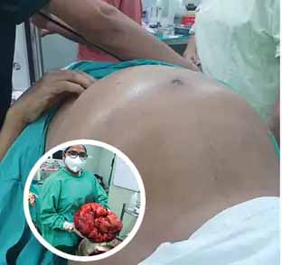 45 वर्षीय अर्नब के पेट में 10 किलो का कैंसरस ट्यूमर सर्जरी करके निकाला गया
