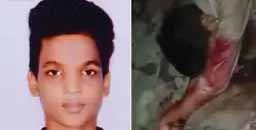 मोबाइल टूटने से नाराज आरोपी ने चाकू से ताबड़तोड़ वार किए, हमला करते हुए बोला- मारकर ही जाऊंगा
