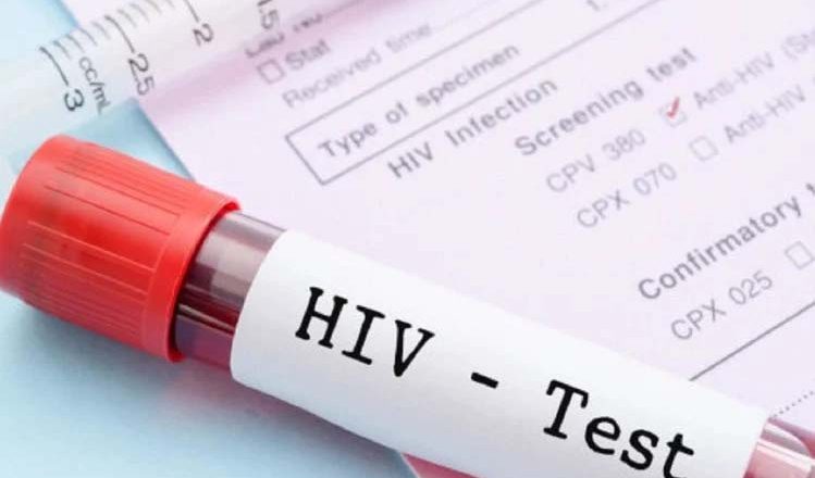 बड़ा सवाल: क्या साल 2030 तक एड्स पर मिल सकेगी जीत?