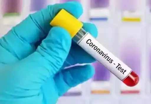 यूक्रेन से आई युवती कोरोना पॉजिटिव; आदर्श नगर में एक अन्य सदस्य भी संक्रमित