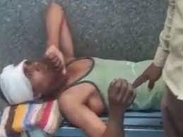 तेज स्पीड में गाड़ी पलटने से दादा, पोता और पोती की मौके पर मौत, 8 अन्य बच्चों सहित 18 घायल