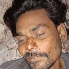 बीकानेर में ट्रेन से कटकर दी जान:घर से परेशान लेट गया ट्रेन के आगे, दो हिस्सों में कटने से हुई मौत
